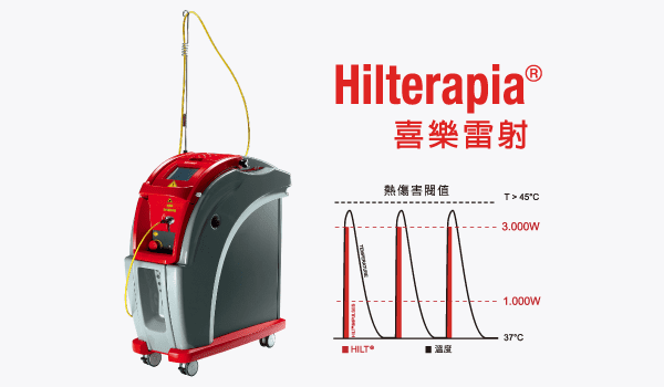 高能量雷射